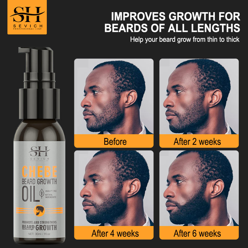 Sevich Men Beard Growth Essent - đánh giá và giá Beard Oil Growth