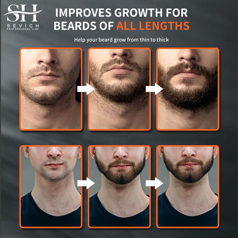 Sevich Men Beard Growth Essent - đánh giá và giá Beard Oil Growth