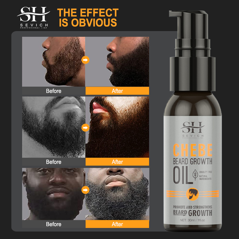 Sevich Men Beard Growth Essent - đánh giá và giá Beard Oil Growth