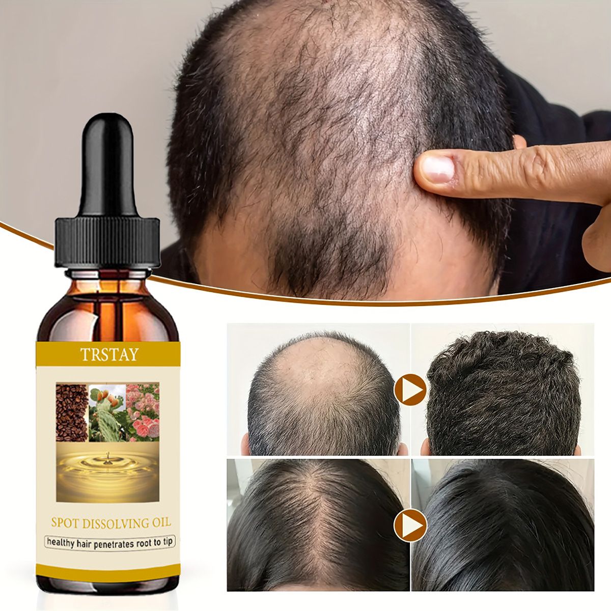 50ML Beard Growth Oil Anti Alo - đánh giá và giá Beard Oil Growth
