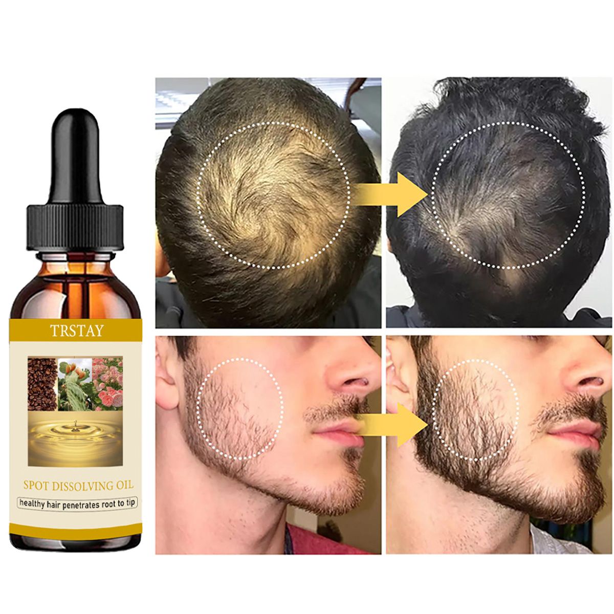 50ML Beard Growth Oil Anti Alo - đánh giá và giá Beard Oil Growth