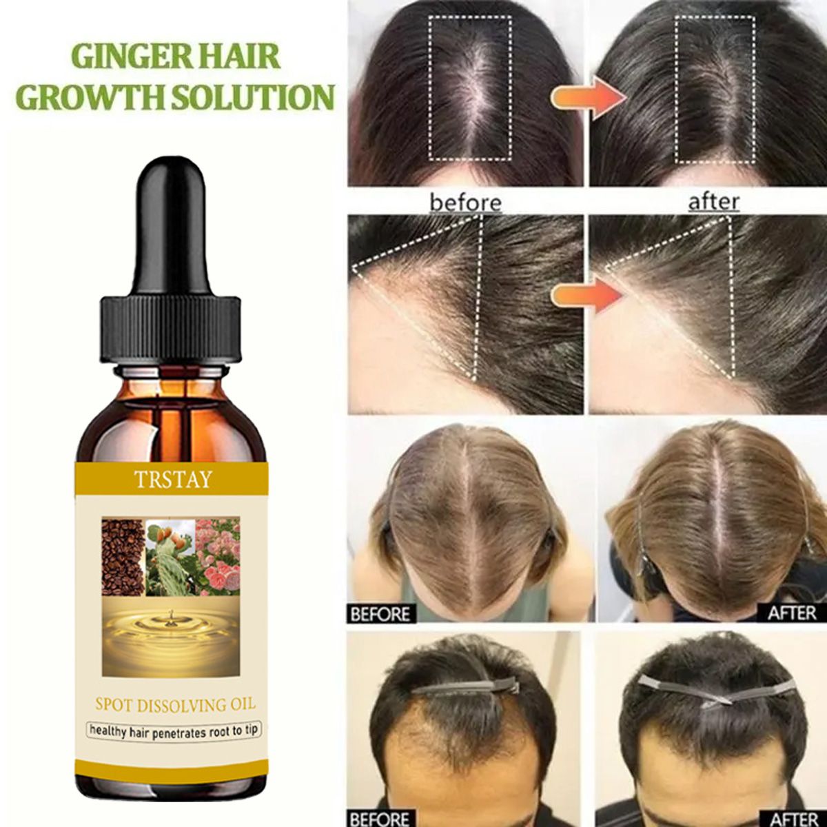 50ML Beard Growth Oil Anti Alo - đánh giá và giá Beard Oil Growth