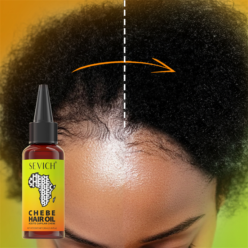 Chebe Fast Hair Growth Oil Afr - đánh giá và giá Beard Oil Growth